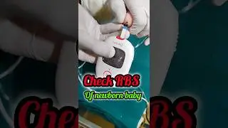New born Rbs check &hearts;️#shorts #newbornbaby #viral #trendingvideo #newborn #cutebaby #RBS #nicuwarrior