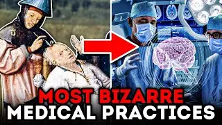Top 5 Most BIZARRE Medical Practices in History