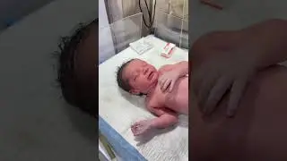 &ldquo;Adorable Baby Birth in Our NICU 👶 | Gentle Placenta Removal 💖 #NICUMiracle #amnioticfluid #nicu