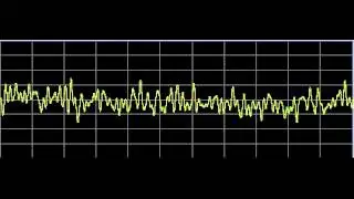 Metabolism Repair - Rife Frequencies