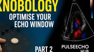 ECHOCARDIOGRAPHY- IMAGE OPTIMISATION 