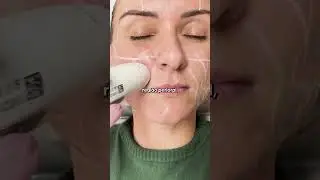 Liftera Full Face O que &eacute;?