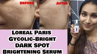 Dark Spot Brightening Serum from the Brand Loreal Paris | Must watch Before Use| Review |