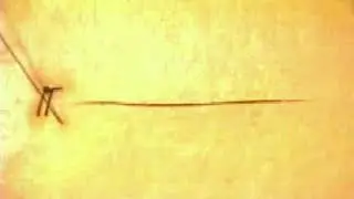 Continuous Suture - CPSP Pakistan