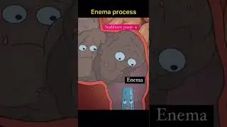 Enema process...   #anatomy #medical #medicalstudent #medicalschool #nurse #nurselife #nursing