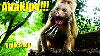 New Update Million Sad! Baby Ronnie Got Attacked Till He Broke His Leg And He Is Poor Boy Now.