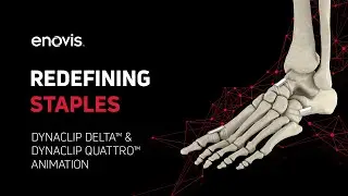 DynaClip Delta&trade; and DynaClip Quattro&trade; Animation