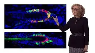 Elaine Fuchs (Rockefeller, HHMI) 2: Tapping the Potential of Adult Skin Stem Cells