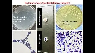 How to differentiate yeast from bacteria instantly?