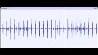 Heart Sounds - Loud, Narrow, Fixed Split S2, Quiet S1, PFO/ASD