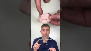 How to correct chin deformity for men and women #looxmaxxing #surgerytiktok #surgery #chin #mento #c