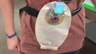 Osto-Mate Demo | Interactive Colostomy Training Model
