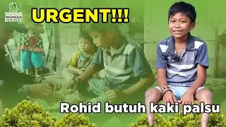Kondisi Rohid yang sangat membutuhkan Kaki Palsu