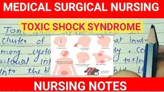 TOXIC SHOCK SYNDROME || MEDICAL SURGICAL NURSING || what is TSS? || How does TSS occur?