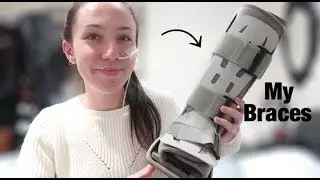 ♡ A Quick Video about My Braces & Supports | Amy's Life ♡