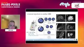 PAARS   Radiographers Radio   Wave 4