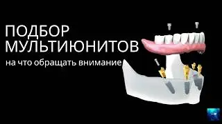 Подбор мультиюнитов — на что обращать внимание?