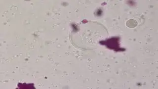 Phase inversion of multiple emulsion (Rhodamine B) #1