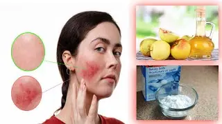 Easy treatment and simple welding face at home