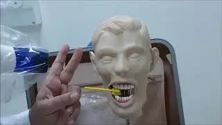 Tube Shift Technique 2