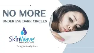 DARK CIRCLES SOLUTION | ALLYN UNDER EYE SERUM | SKINWAVE | SHUBHAM NIMJE 