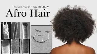 The Science of Black Hair: From Growth to Loss and Everything In-Between