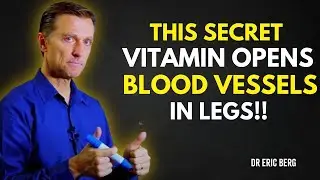 Struggling with Leg Cramps These 3 Vitamins Could Bring Your Strength Back Fast  Dr  Eric Berg