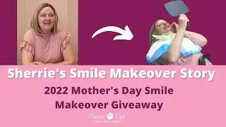 Sherrie's Smile Makeover Story | Mother's Day Smile Makeover Giveaway