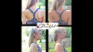 Scoliosis Treatment Comparison Pics - ScoliosisKC