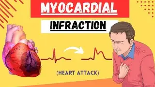 Myocardial Infraction | Heart Attack | Pathology | MBBS 2nd prof. Lectures | Quick revision