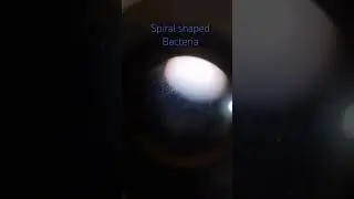 #spirillum bacteria#spiral shaped bacteria when observed with the help of compound microscope#shorts