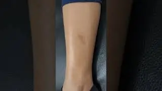 scar cover up Tattoo
