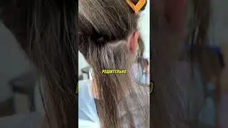 Как избавиться от вшей ? #reels