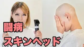 抗がん剤を打つのでスキンヘッド