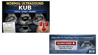 Normal Ultrasound KUB with Report | Kidney Ureter Bladder | Students & Patients. Medical Reports Hub