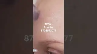 #porecleanser#blackheadremover#skincleaner | For order-8708597077