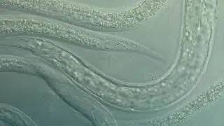 Caenorhabditis elegans, a free-living, transparent nematode (roundworm)