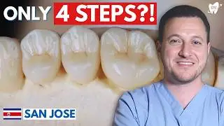 How Are Dental Crowns Made? Costa Rica's Top Dentist Explains With a Lab Tour!
