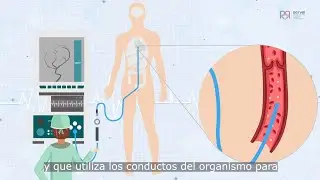 &iquest;Qu&eacute; es la Radiolog&iacute;a Vascular Intervencionista?