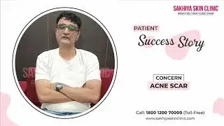 Best Acne Scar Treatment in India | Sakhiya Skin Clinic Success Story | Before & After Results