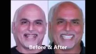 Best Dentist in San Diego &ndash; San Diego Dental Implants!
