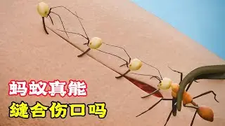 神奇的小螞蟻，竟能縫合傷口，還被稱為自然急救包！科普動畫《螞蟻縫傷口》。電影，短片，成精，解說，搞笑，動畫，動作，喜劇，獵奇，奇幻，腦洞，科幻，超能力，short film