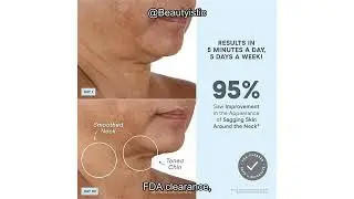 NuFACE Mini+ Review: Is This FDA-Cleared Microcurrent Device Worth the Investment for Your Skin?