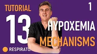 Tutorial 13 Mechanisms of Hypoxia-Hypoxemia
