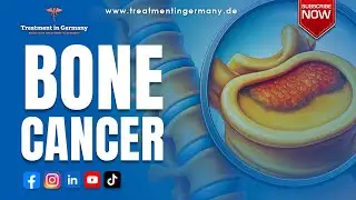 Advanced Bone Cancer Treatment in Germany