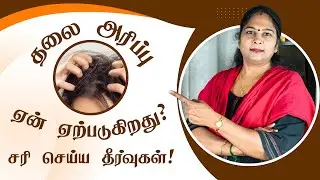 Itchy Scalp&nbsp;| Home Remedies | தலை அரிப்பு பிரச்சனைக்கு தீர்வு #haircaretips #beautytips #itchyscalp