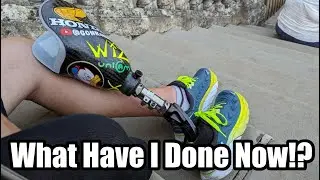 What Have I Done Now?! #amputee #prostheticleg
