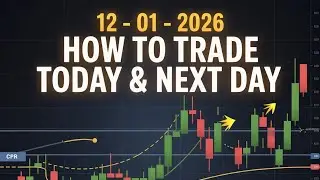 HOW TO TRADE  OD SET UP