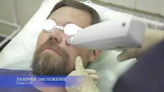 Лазерное омоложение Clear Lift