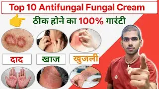 Dad Khaj Khujli Ki Dawa | fungal infection treatment | ringworm treatment in hindi 
